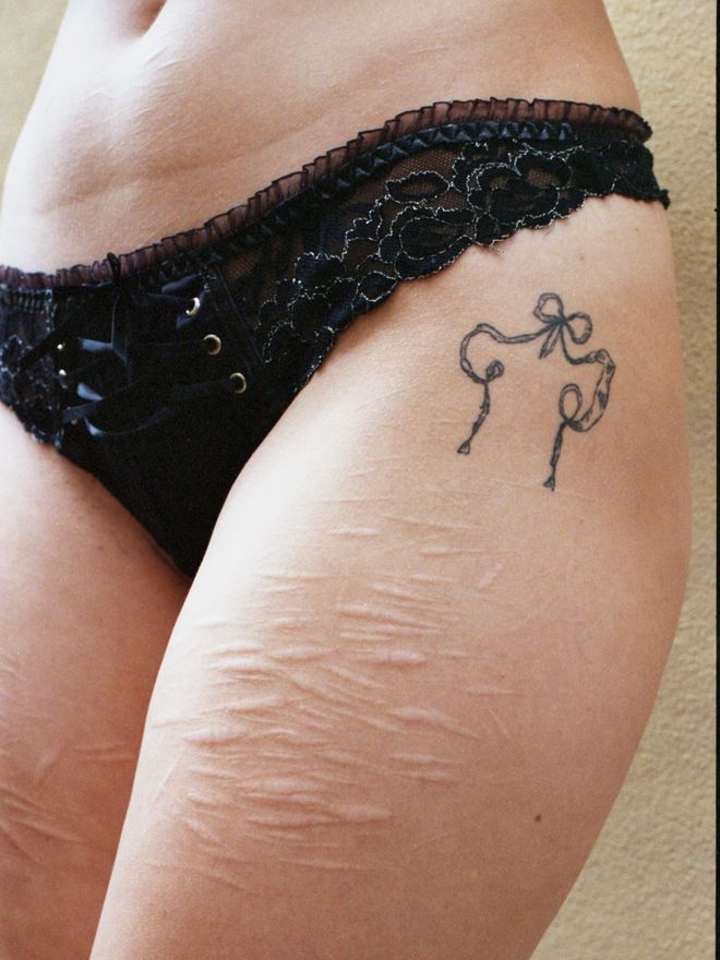 Fianco e coscia di una persona in slip di pizzo nero, con un piccolo tatuaggio a fiocco e cicatrici chiare sulla pelle.
