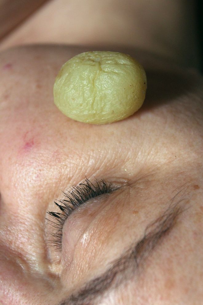 Volto di donna a occhi chiusi, con un piccolo frutto raggrinzito appoggiato sulla fronte.