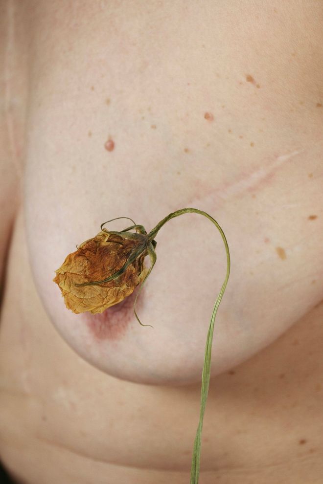 Un seno con una cicatrice e piccoli nei, accanto a una rosa secca dal gambo sottile.