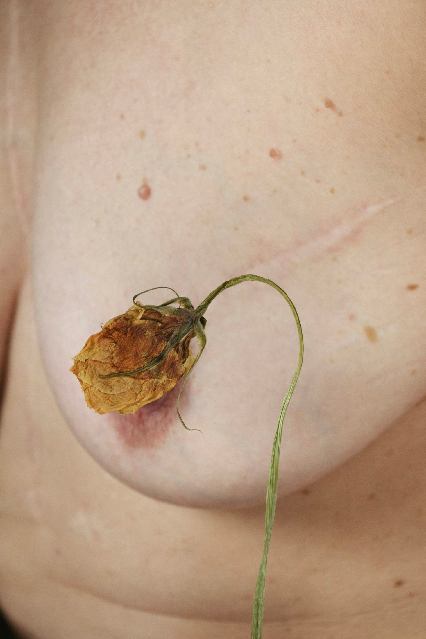 Un seno con una cicatrice e piccoli nei, accanto a una rosa secca dal gambo sottile.