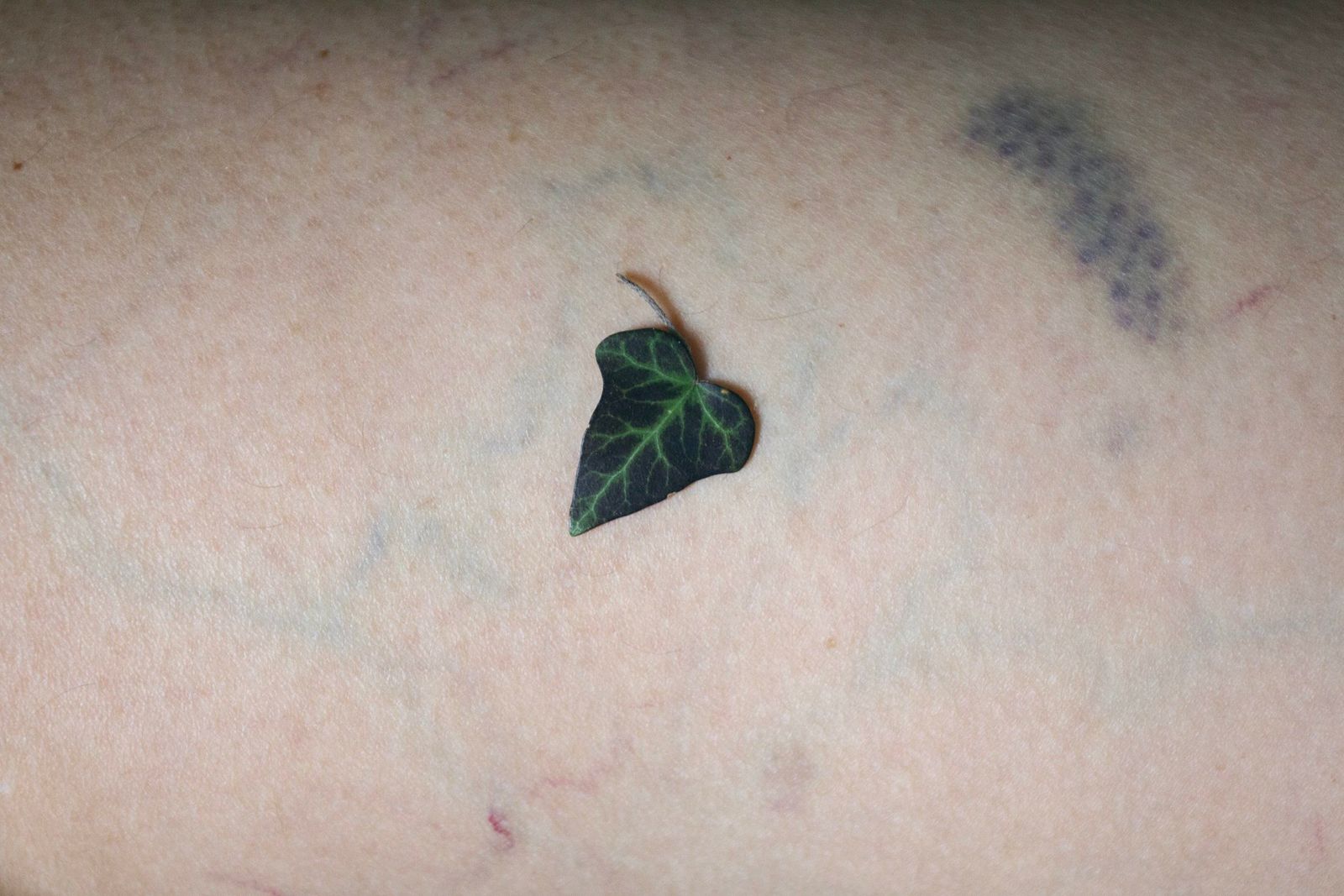Una foglia d'edera appoggiata sulla pelle chiara, attraversata da vene e da un livido.